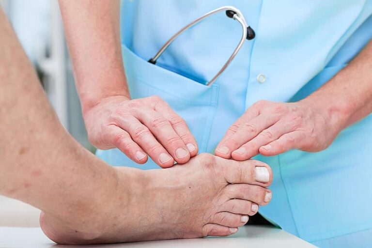 What Are The Available Bunion Treatments & Surgery Options In Singapore?
