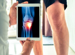 Orthopaedic Clinic In Singapore - Orthocare