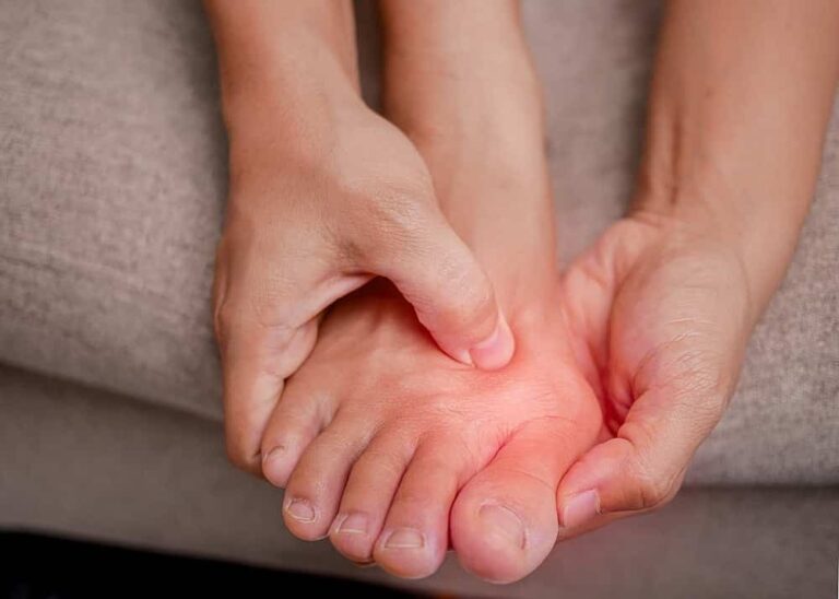 What Are The Symptoms Of Bunions?