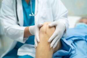 What you Need to Know About Total Knee Replacement Recovery