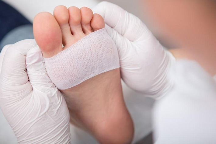 Toe Fractures